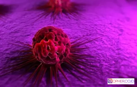 kanker paling ganas mematikan