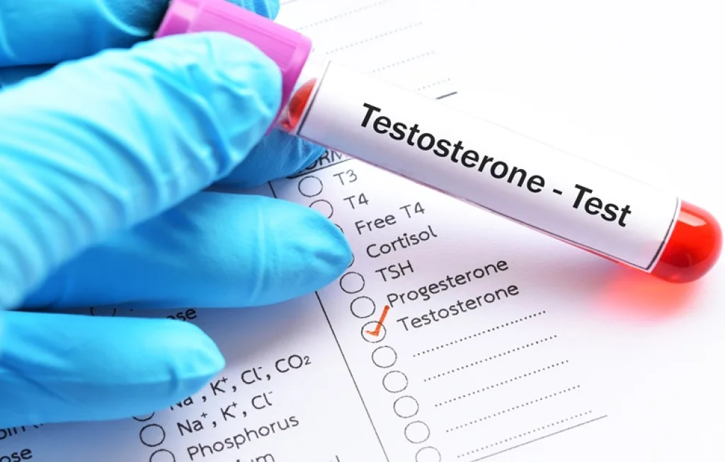 low testosterone prostate cancer