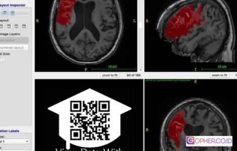 open data stroke recovery