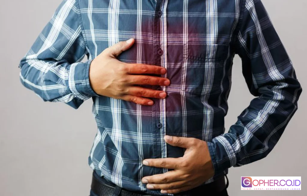 persiapan mudik penderita gerd