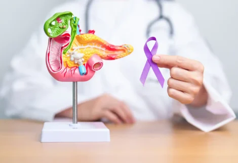 Kerentanan Tumor Pankreas, Celah Baru Obati Kanker
