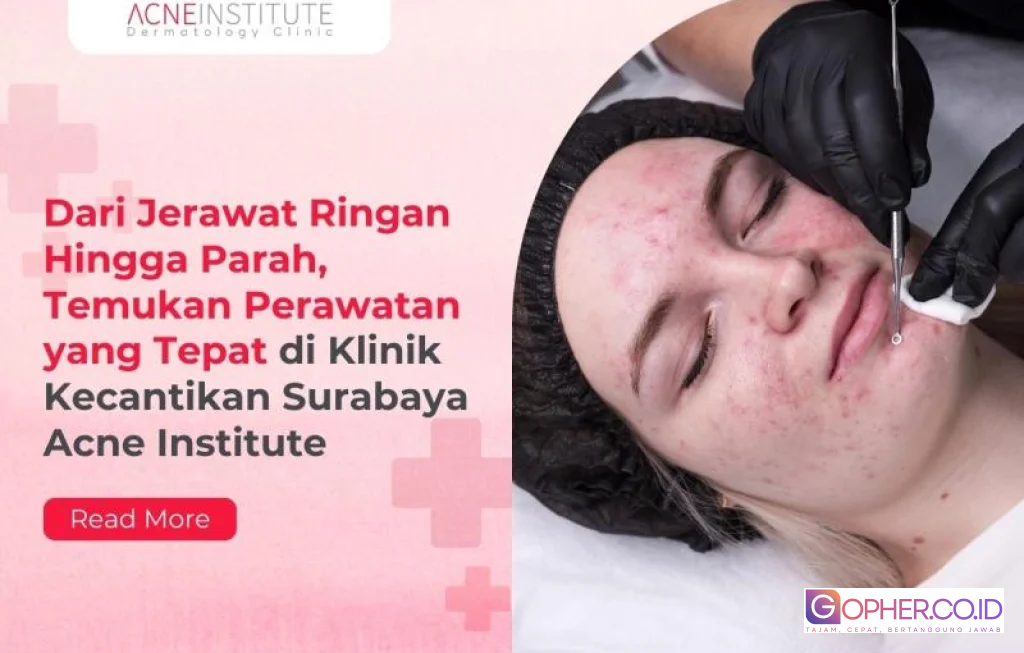 perawatan jerawat ringan hingga parah