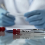 Ebola